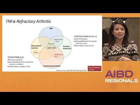 IBD: Treatment Options for Patients with Extraintestinal Manifestations