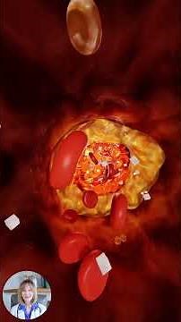 Alpha Lipoic Acid: The Ultimate Antioxidant for Longevity & Health