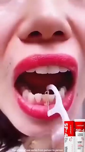 😁✨ Introducing YAYASHI SP-4 Ultra Whitening Toothpaste! 🦷🌿 🇵🇰 Trusted by thousands across Pakistan ✅ Whiter teeth in just weeks ✅ Stronger gums & less bleeding ✅ Long-lasting fresh breath 🌬️ ✅ Gentle on sensitive teeth 🧡 ✅ Probiotics for a healthy mouth 🌱 🥰 “My teeth feel cleaner & brighter all day!” – Happy Customer 📦 Cash on Delivery available all over Pakistan 📲 Order Now on WhatsApp: 0331-3547107 | Smart Accessories