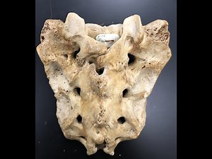 Anatomy of the Sacrum: Part Plus a Brief Overview of Spine-Related Nerves and Their Passageways.