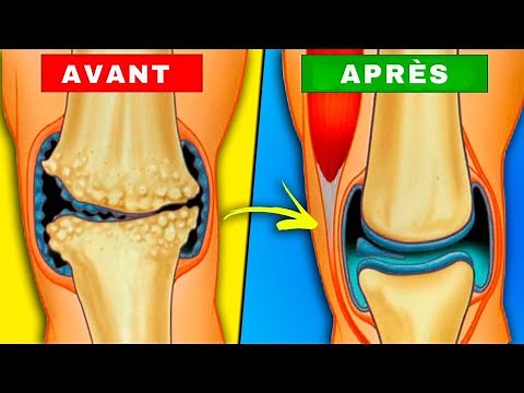 Douleur au genou : 10 aliments clés pour régénérer le cartilage