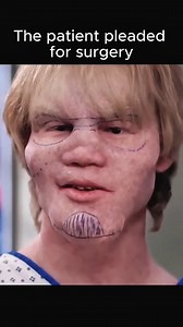 The doctor's most difficult facial surgery. Best Netflix Movie 2025 #movie #new #films #bestfilm #movietime #movieclips | Latest news tonight