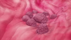 Cancer cell growth uncontrollably over tissue 3d animation. Tumor growing and spreading over healthy tissue causing inflammation and metastasis