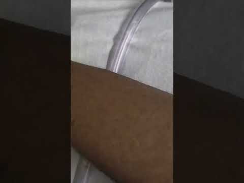 Requesting a condom catheter at Centennial Hills Hospital