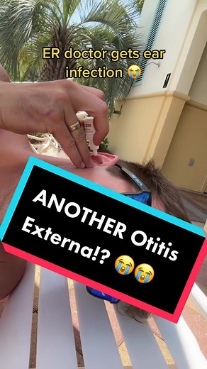 Check out how disgusting my last ear infection was here 🤢🤣 @J Mack Slaughter, MD #otitisexterna #earinfection #swimmersear #earproblems