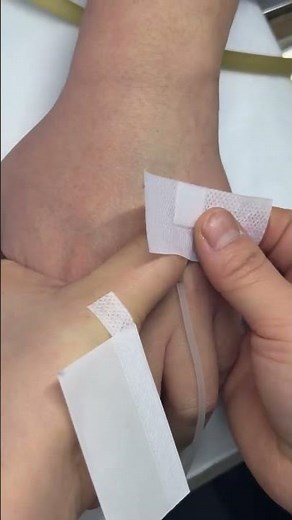 Intramuscular Injection Technique Explained Safe | IM Injection Step-by-Step #injektion #injection