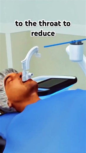 Bronchoscopy 3D Animation #lungs #bronchoscopy #medical #3danimation