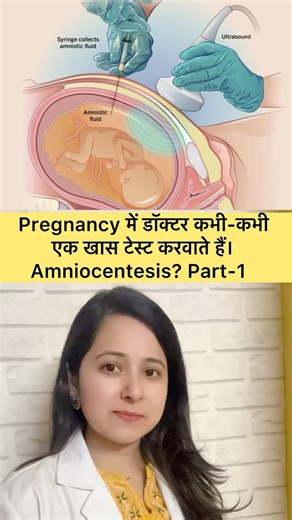 Amniocentesis Test in Pregnancy | Why It Is Done| #drsnehadj #pregnancy #geneticdisorder #baby