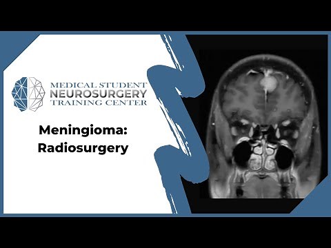 Meningioma: Radiosurgery