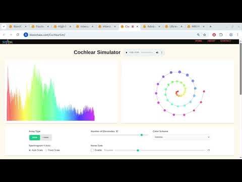 Cochlear Implants & Music: Deep Dive into Empathetic Audio Engineering