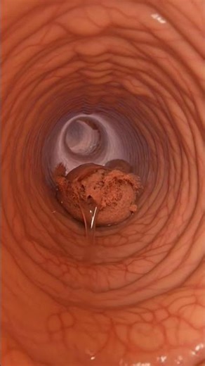 Animation of Gut Internal View with Food