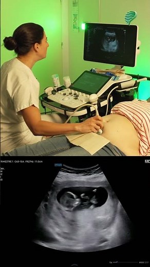 Complete your ARDMS®, APCA®, or ARRT® CME online with 65+ accredited Ultrasound CME credits.