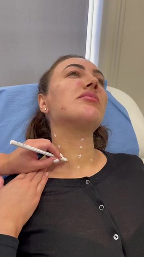 #profhilo #profhilotreatment #profhiloinjection #profhilobeforeandafter #hydration #primeaesthetics #primesevenoaks #profhiloneck #necktreatment