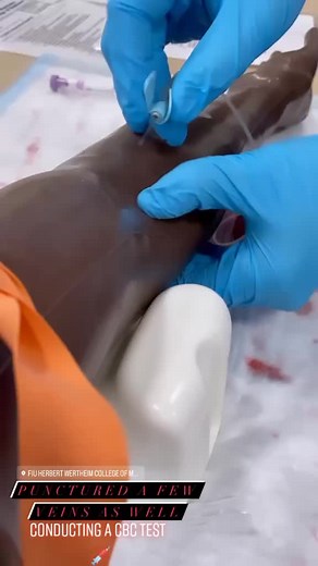 Conducting a CBC test in the lab🩺💉