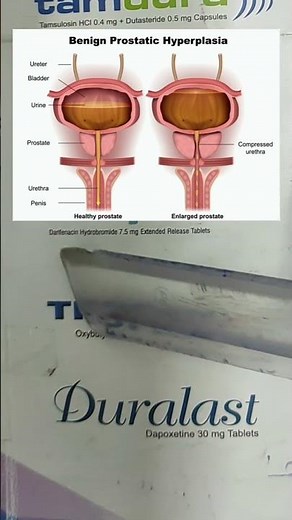 TropanXL (Oxybutynin) | Use, side effects, Dose, Precautions #medicine #pharma #share #viral