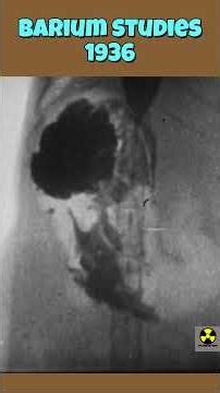 Barium Studies | Fluoroscopy - 1936 #radiology #x-ray