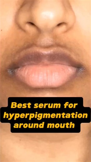 Best Products for Hyperpigmentation | Clear & Even Skin