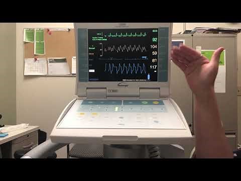 IABP troubleshooting