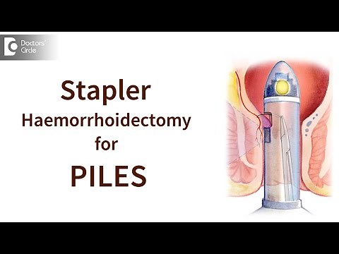 Minimally Invasive Procedure for Piles' (MIPS) or 'Stapler Haemorrhoidectomy - Dr.Nanda Rajneesh