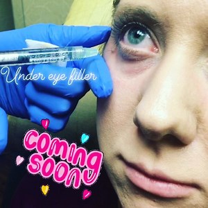 26 reactions · 15 comments | Tear trough filler does what creams and...