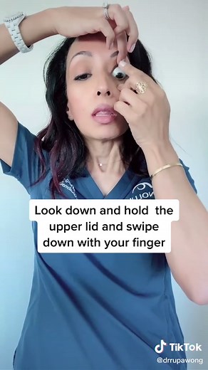 How to Remove a Stuck Contact Lens from Under Your Eyelid