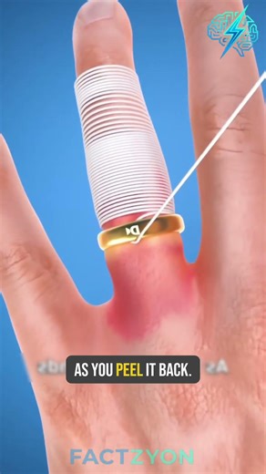 Ring Stuck on Finger? This Trick Actually Works 😳💍 #facts #ring #finger #fingerhands #caringhands