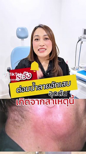 ระวัง ต่อมน้ำลายอักเสบอุดตัน เกิดจากอะไร?