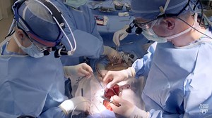 Hypertrophic cardiomyopathy and treatment options - Mayo Clinic