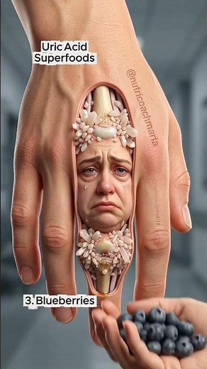 How to eat to lower uric acid