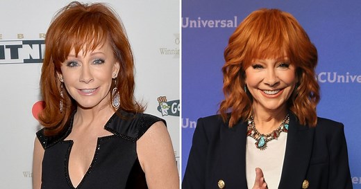 Has Reba McEntire Had Plastic Surgery? ‘The Voice’ Coach Addressed Rumors in the Past