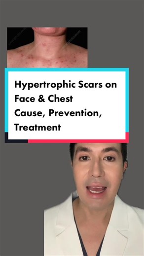 Hypertrophic Scars: Face & Chest Treatment