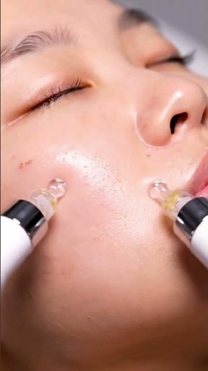 “From Clogged to Clear in 10 Seconds 🤯 | Fast Tech ASMR Facial”