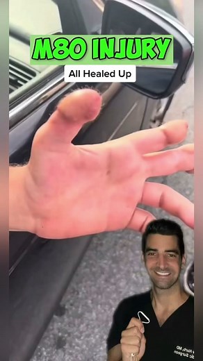 Skin Graft vs Flap Surgery Explained