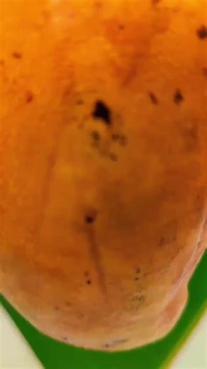 ❤️‍🩹❤️‍🩹🫀🫀❤️‍🩹❤️‍🩹