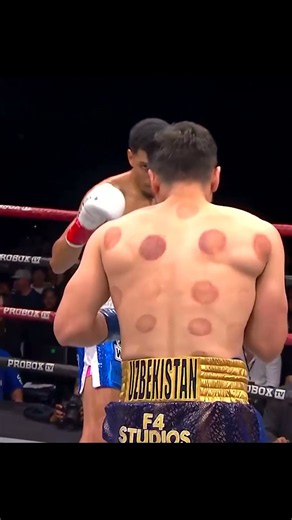 Kevin Anton: Tall, Southpaw, And He Can Punch | Anton vs Rojas, October 16
