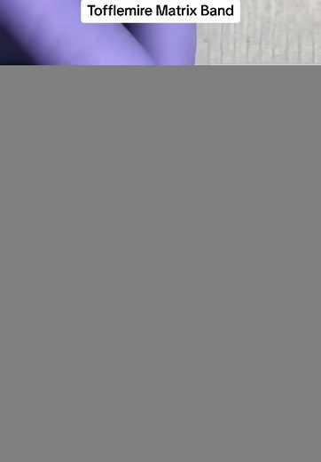 Using the Tofflemire Matrix Band and Holder Like a Pro