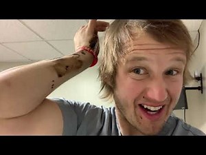 How to get tar out of your hair - an Emergency Room Doc’s personal recommendations