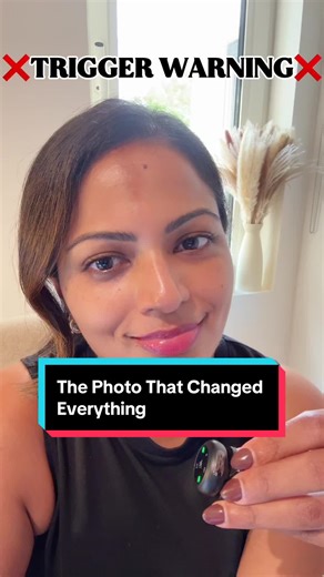 Understanding Pores and Hyperpigmentation in Aging Skin