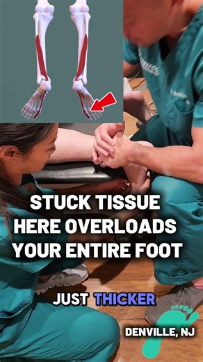 Big Toe Pain? This Muscle Might Be the Problem