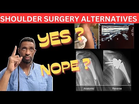 5 Alternatives To Shoulder Replacement Surgery That You Should Know Now