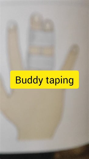 physioguide by divyaA on Instagram: "Buddy taping #buddy #buddytaping"
