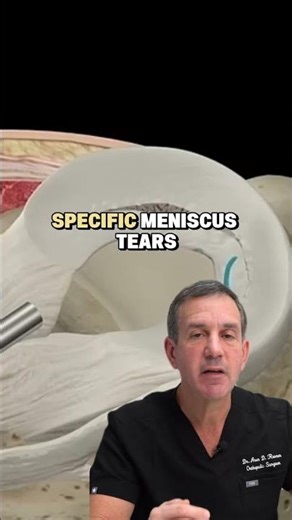 Faster meniscus recovery technique