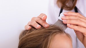 Kopfläuse erkennen und Nissen richtig bekämpfen