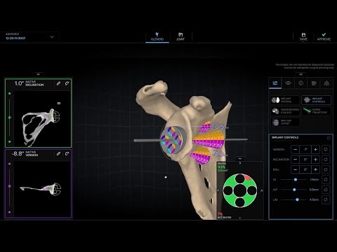 VIP™ Vision: Episode 4— Introducing the New VIP Depth of Ream Instrumentation