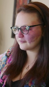 The meme - titled ‘One Like = Beautiful’ - subjected Crystal to brutal cyberbullying and it reached over 30 million views | Born Different