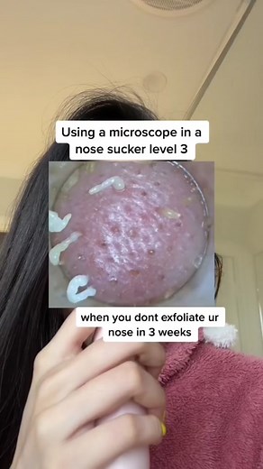 Discovering Sebaceous Filaments Under the Microscope - A Skincare Analysis