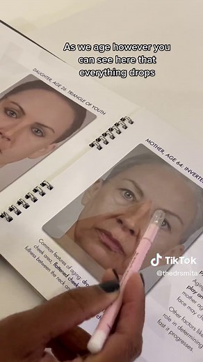 Ever wonder what people are referring to when they mention the triangle of youth? #nj #nyc #filler #facelift