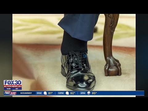 White House releases diagnosis on Trump's health problems, leg swelling