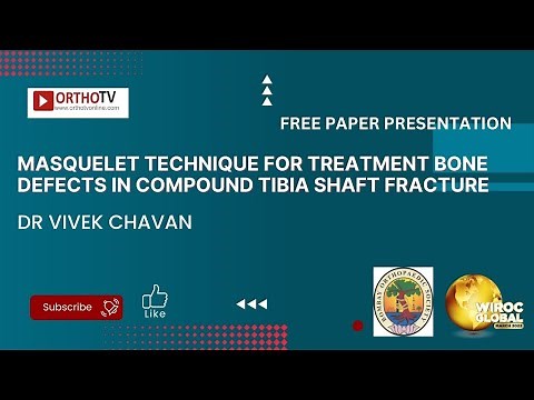Masquelet Technique for Treatment Bone Defects in Compound tibia shaft fracture - Dr Vivek Chavan