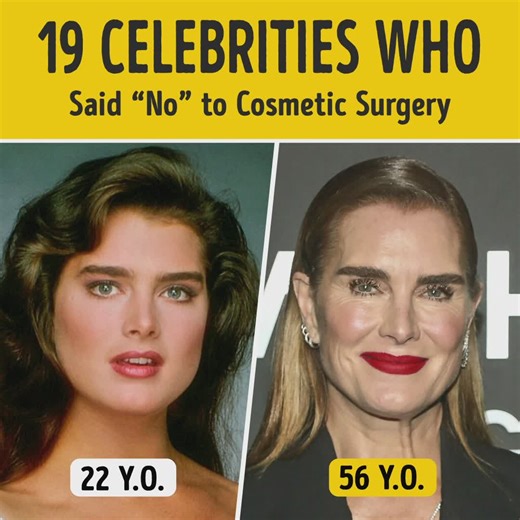 1.4M views · 10K reactions | 19 Celebrities Who Said “No” to Cosmetic Surgery | You're Gorgeous | Facebook